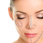 סרטוט על פנים של אישה שעבר ניתוח אף